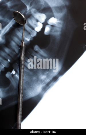 Panorama-Röntgenaufnahme Bild scannen von Menschen Zähne und Mundspiegel Stockfoto