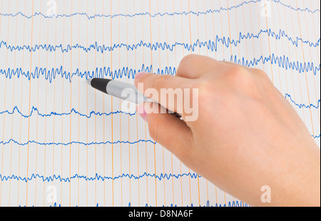 Arzt-Hand mit Stift und EKG Stockfoto