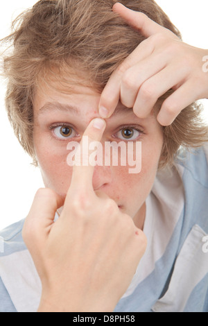 teenboy quetschen Akne vor Ort Stockfoto
