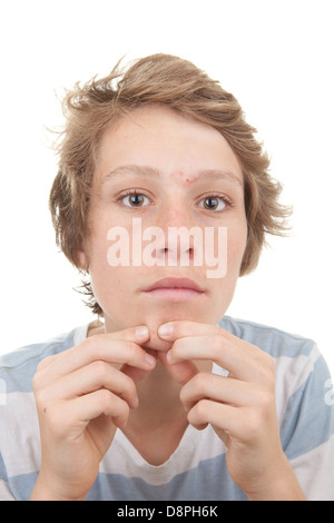 Kind mit Pubertät Akne Flecken Stockfoto