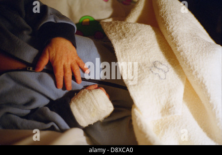 Ein Baby mit einem Verband an der Hand. Stockfoto