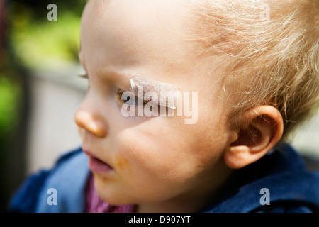 Ein kleiner Junge mit Gips im Gesicht. Stockfoto