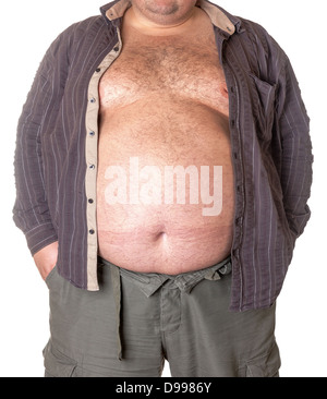 Dicker Mann mit einem dicken Bauch, close-up Teil des Körpers Stockfoto