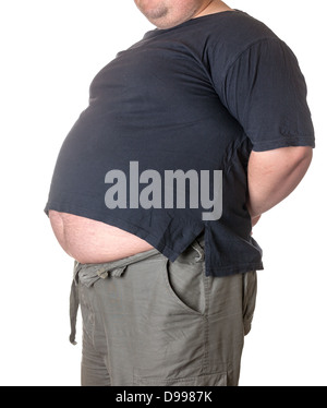 Dicker Mann mit einem dicken Bauch, close-up Teil des Körpers Stockfoto