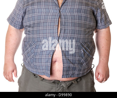 Dicker Mann mit einem dicken Bauch, close-up Teil des Körpers Stockfoto