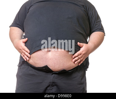 Dicker Mann mit einem dicken Bauch, close-up Teil des Körpers Stockfoto
