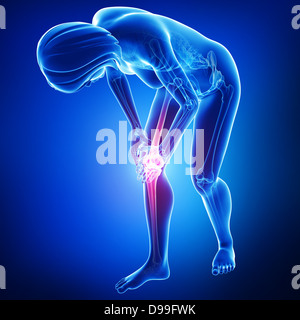 menschlichen Knie Schmerzen Anatomie in blau Stockfoto