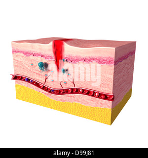 Anatomie der Reparatur von Gewebe in der menschlichen Haut ...