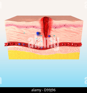 Anatomie der Reparatur von Gewebe in der menschlichen Haut ...