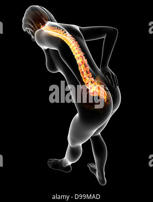 Anatomie der menschlichen Rückenschmerzen Stockfoto