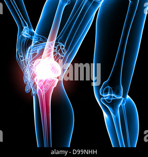 Anatomie der menschlichen Knie Schmerzen Stockfoto
