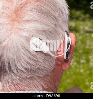 Eine Nahaufnahme von einem älteren Mann mit seinem Hörgerät Cochlea-Implantat in England, Großbritannien, Vereinigtes Königreich Stockfoto