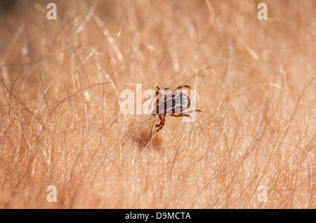 Makro-Bild des amerikanischen Hundezecke am menschlichen arm Stockfoto