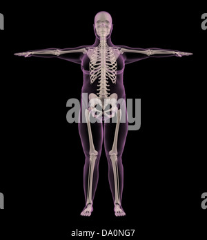 3D Rendern eines medizinischen Skeletts einer übergewichtigen Frau Stockfoto