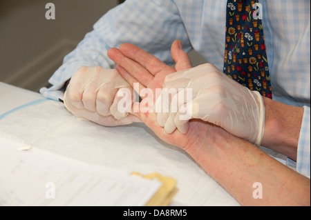 Der Dupuytren'schen Kontraktur Behandlung des kleinen Fingers auf eine Frau Hand Arzt Bearbeiten von Hand Verfahren Stockfoto