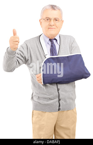 Ältere Mann mit gebrochenen Arm Daumen aufgeben Stockfoto