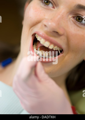 Zahnarzt untersuchen junge Frau Zähne, Nahaufnahme Stockfoto