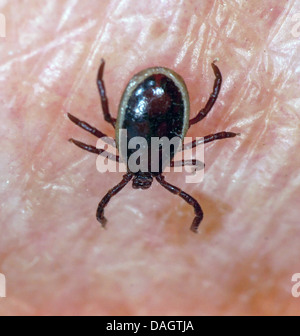 Europäische Rizinuspflanze Tick, europäischen Schafe Zecke (Ixodes Ricinus), Zecke auf der Haut, Deutschland, NRW Stockfoto