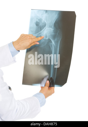 Closeup auf Arzt Frau zeigt auf fluorography Stockfoto