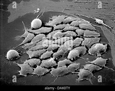 HANDOUT - zeigt ein undatiertes Rasterelektronenmikroskop Handout Bild vom Max-Planck-Institut für molekulare Biomedizin embryonalen Stammzellen der Maus in Münster. Zahlreiche Wissenschaftler des Instituts an der Universität Münster sind Stammzellenforschung beteiligt. Foto: Mpi Münster Stockfoto