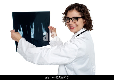 Ärztin, die Überprüfung der Röntgen-Blatt eines Patienten Stockfoto