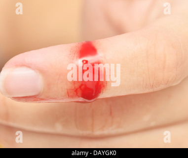 Fleischwunde mit Blut am finger Stockfoto