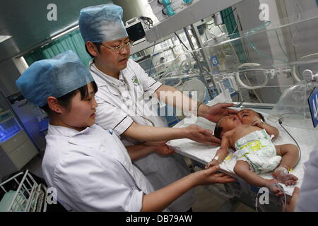 ZWEI Spitze BABY Conjoined weibliche Zwillinge waren am 5. Mai 2011 in Suining Stadt geboren. Beiden vorangegangenen Ultraschall scannt im September und Februar beide Revealled nur einen einzigen Embryo, aber eine endgültige-zwei Tage vor der Geburt Revealled Scan, die Tochter der Mutter Stockfoto