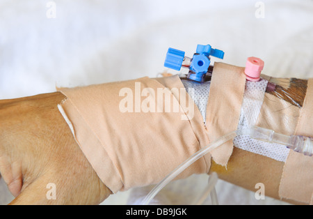 Arterie Katheterisierung auf Patienten arm Stockfoto