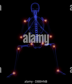 3D Illustration - schmerzende Gelenke Stockfoto