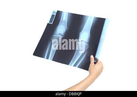 Frau Hand hält eine Knie-Radiographie isoliert auf weißem Hintergrund Stockfoto