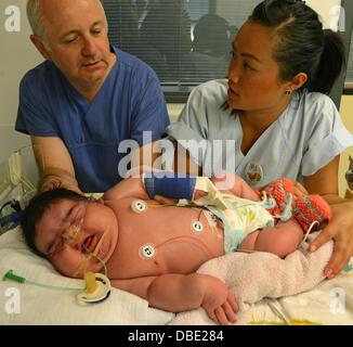 Leipzig, Deutschland. 29. Juli 2013. Facharzt Matthias Knuepfer und Krankenschwester ist mein kümmern sich um Deutschlands schwerste Neugeborene bis jetzt in der neonatalen Intensivstation des Universitätsklinikums in Leipzig, Deutschland, 29. Juli 2013. Das Mädchen wurde Jasleen außergewöhnliche 6.110 g wiegen und Messen 57,5 cm lang vor vier Tagen geboren. Die Mutter nur am Tag der Geburt im Krankenhaus angekommen und litt an einer unentdeckten Schwangerschaftsdiabetes. Foto: WALTRAUD GRUBITZSCH/Dpa/Alamy Live News Stockfoto