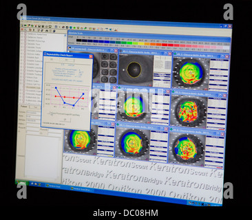 Computer während der Augenlaseroperation (Lasik) verwendet. Stockfoto