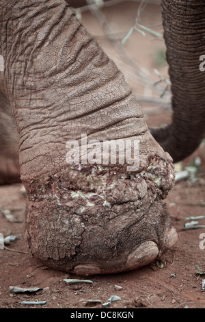 Fuße des Elefanten, die in Wilderer Schlinge gefangen worden waren. Gespeichert von David Sheldrick Wildlife Trust. Kenia Afrika Stockfoto