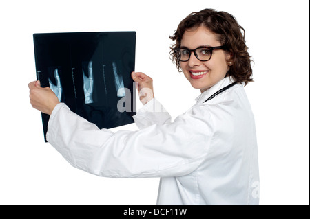 Arzt hält Röntgen-Bericht von ihrer Patientin, den Fall genau zu studieren. Stockfoto