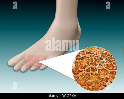 Anatomie der Fußpilz mit mikroskopischen Nahaufnahme. Stockfoto