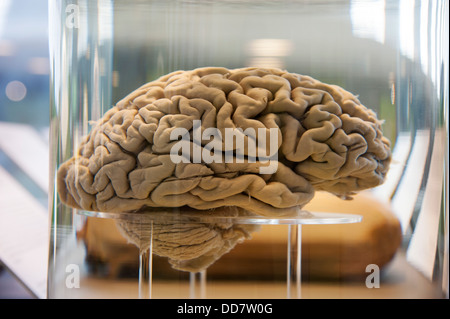 menschliche Gehirn in einem Glas-Container mit klarer Flüssigkeit gefüllt Stockfoto