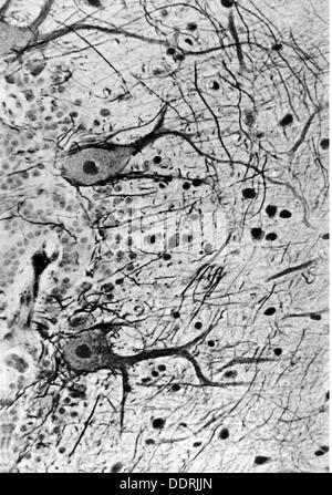 Medizin, Anatomie, Großhirn / Schädel, Kortisen des menschlichen Kleinhirns, Purkinje-Zellen mit Dendritarborisierung, Foto von Dr. Adelheid Winkelmann, 20. Jahrhundert, 20. Jahrhundert, Mikroskopie, Nervenzellen, Nervenzellen, Neural, Neuritisch, Nervenbahnen, Nervenbahnen, Nervenbahnen, Hirnrinde, Kleinhirn, Dendrit, Dendriten, Medizin, Medikamente, Purkinje-Zellen Historische, historische, zusätzliche-Rechte-Clearences-nicht verfügbar Stockfoto