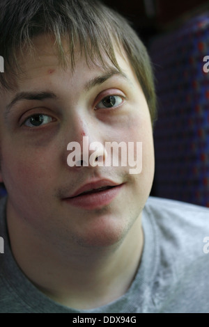 Barry-John im Alter von 22 autist Stockfoto