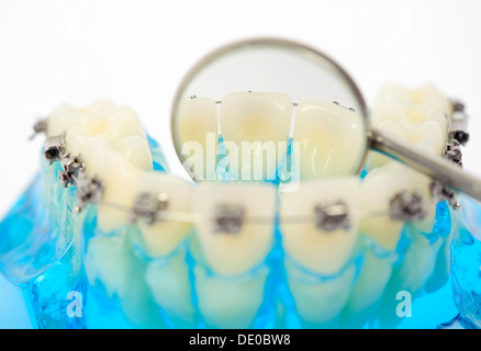 Zahnpflege, Zahnersatz mit festsitzenden Zahnspangen und ein zahnmedizinischer Spiegel Stockfoto