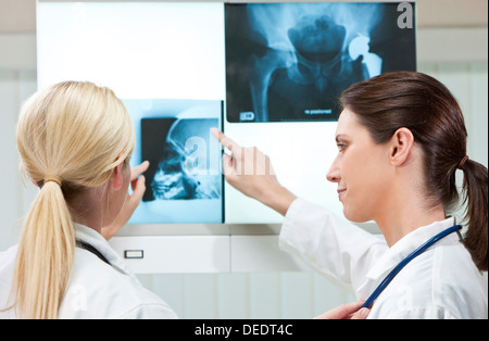 Zwei weibliche Frauen Ärzte Blick auf Röntgenaufnahmen im Krankenhaus Stockfoto