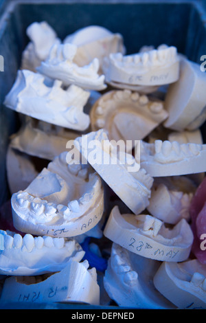 Gipsformen Zähne in blauen Kästchen Stockfoto