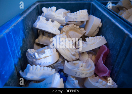 Gipsformen Zähne in blauen Kästchen Stockfoto