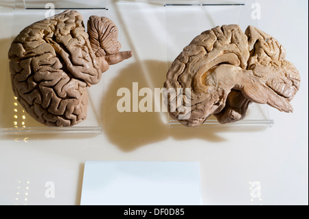 Plastination Exemplar der Midsagittal Schnitt des menschlichen Gehirns Stockfoto