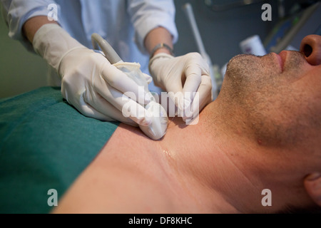 SCHILDDRÜSE, BIOPSIE Stockfoto