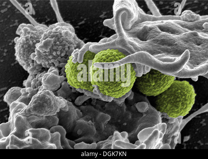 MRSA, Staphylococcus Aureus-Bakterien Stockfoto