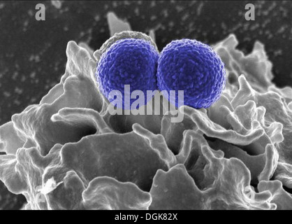 MRSA, Staphylococcus Aureus-Bakterien Stockfoto