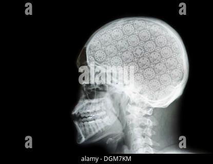 Röntgenbild eines Schädels mit Zähnen Stockfoto