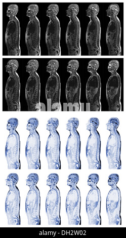 Komplette real MRI scan den oberen Teil des menschlichen Körpers Stockfoto