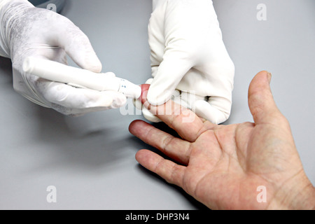 Der Bild-Blut-Zeichnung auf Fingerkuppen und finden Anomalien. Stockfoto