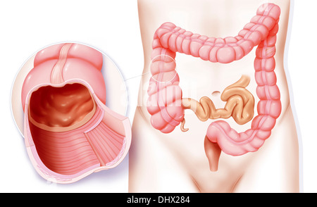 COLON, ZEICHNUNG Stockfoto